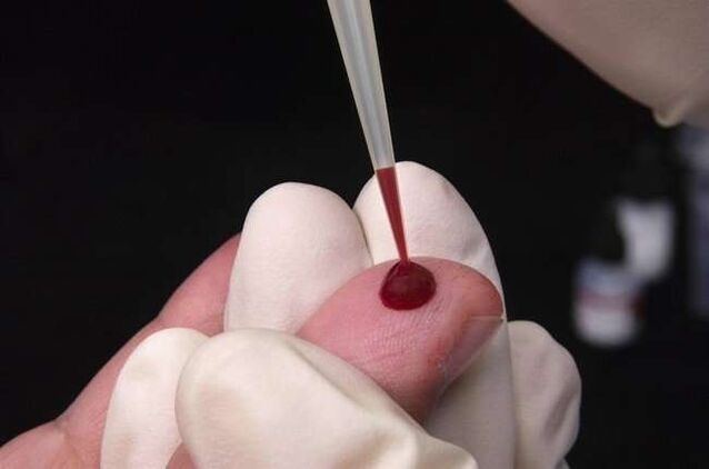 взятие крови на паразитарный анализ