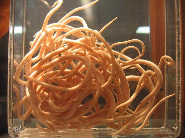 Круглые черви – это черви, относящиеся к классу круглых червей. 